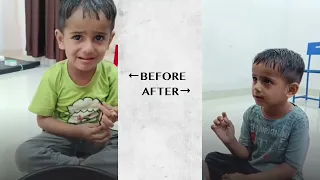 Trasformation of WBVF Mamta Rehab Centre Children